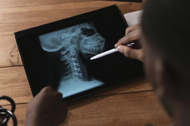 Persona tocándose el cuello con dolor, ilustrando la cervicalgia
